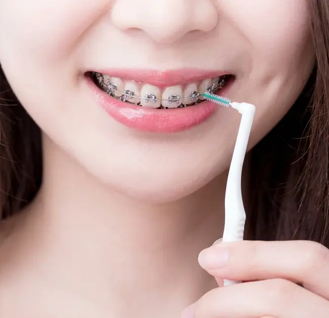 Bàn chải kẽ răng tạo ra trải nghiệm mới về chăm sóc răng miệng tinh tế